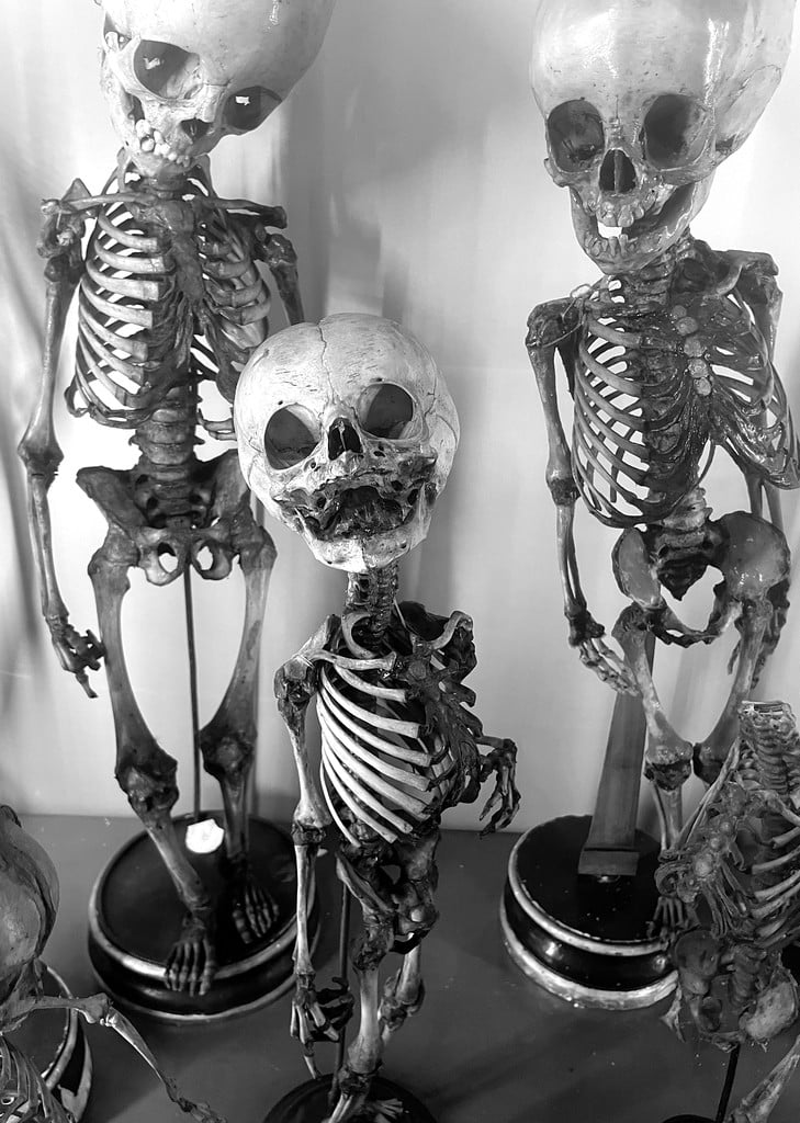 Squelettes d'enfants dans le Musée d'anatomie de Naples.