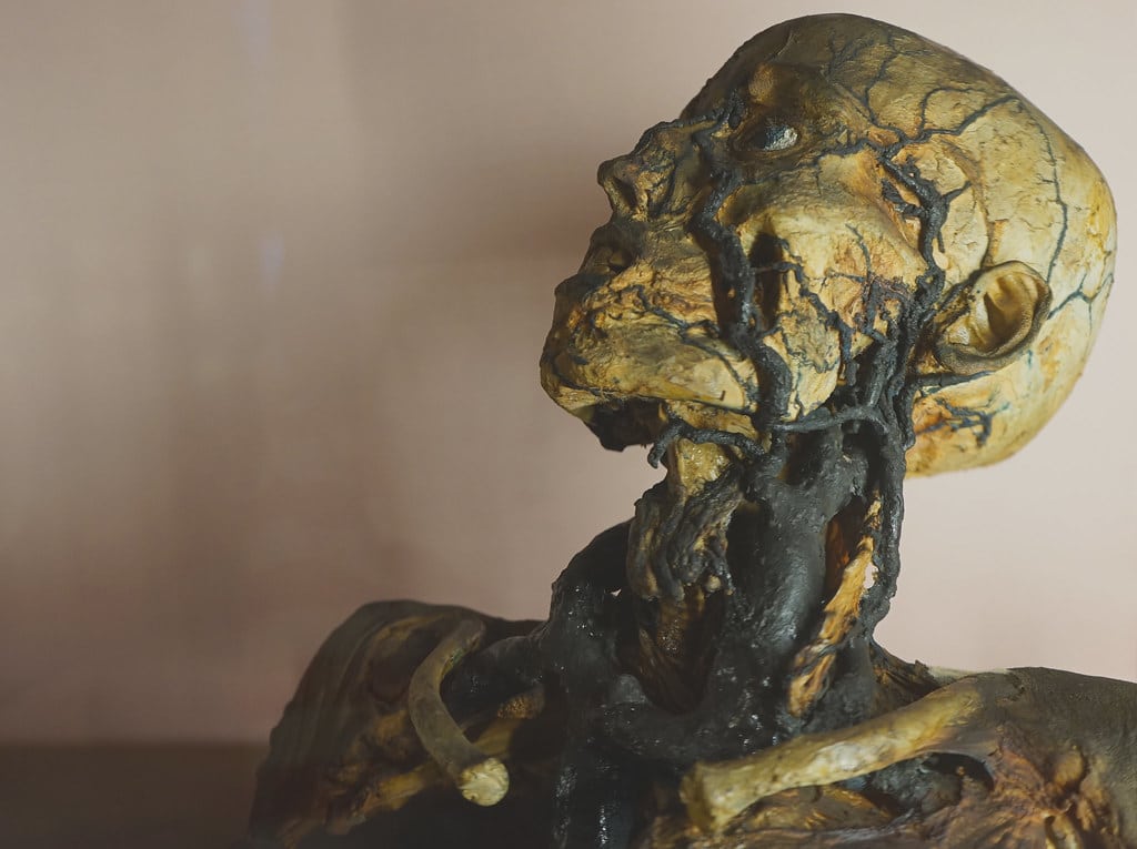 Artère carotide au Musée d'anatomie de Naples.
