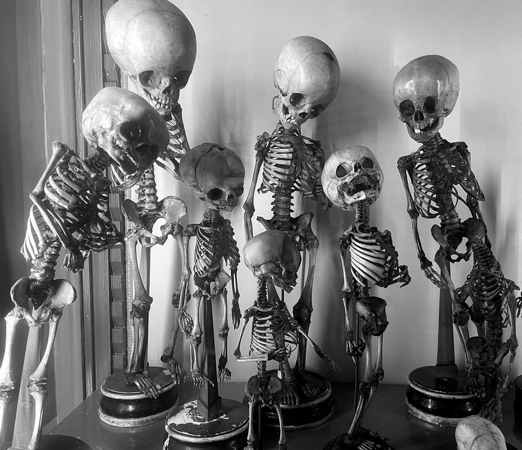 Squelettes d'enfants dans le Musée d'anatomie de Naples.